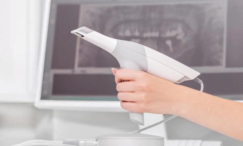 The Impact of the ITERO® ELEMENT™ INTRAORAL SCANNER on Dental Professionals
