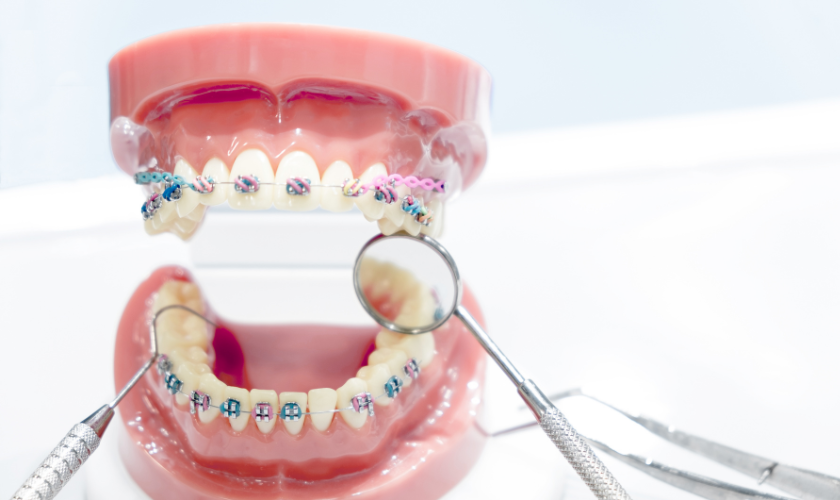 Orthodontic treatment Arlington